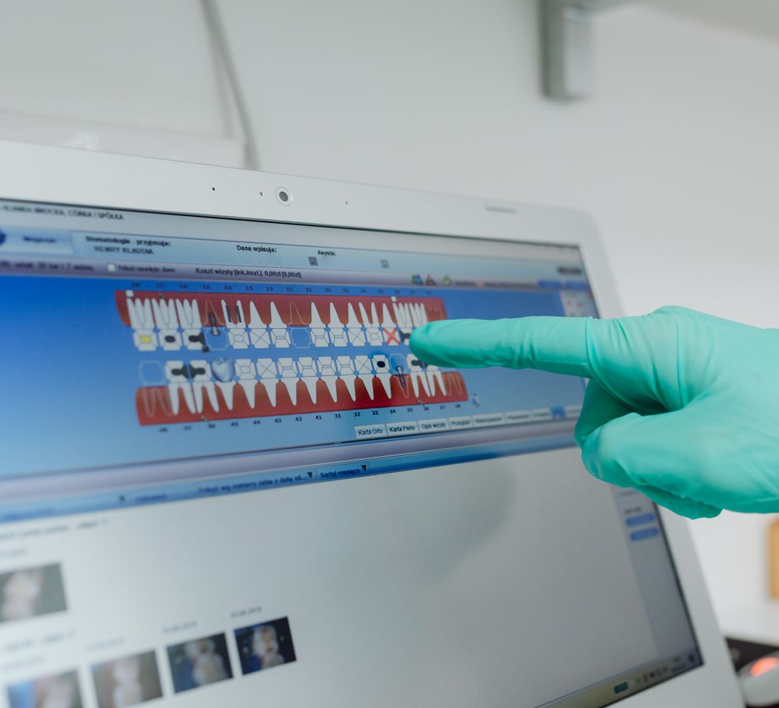 Intraoral digital scanner in use