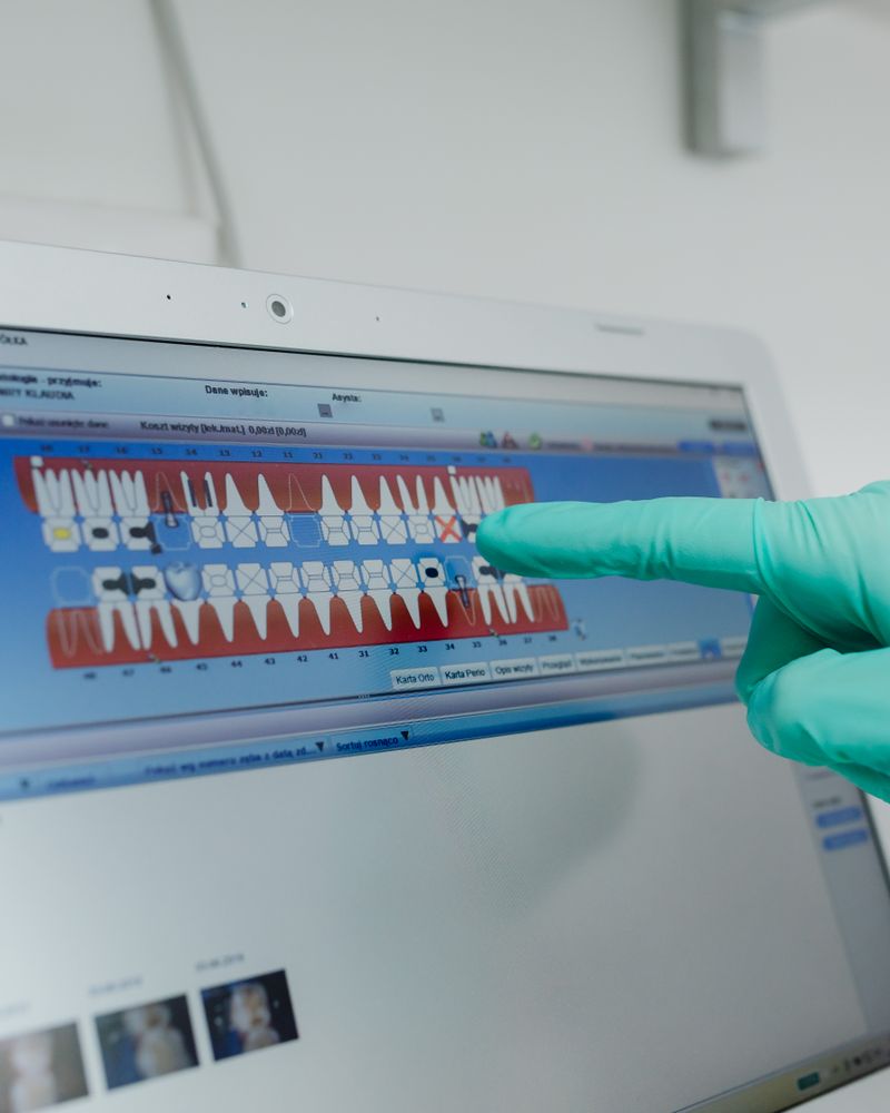 Intraoral scanner in use